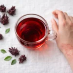 Does Hibiscus Tea Stop Eczema Itching? The Research